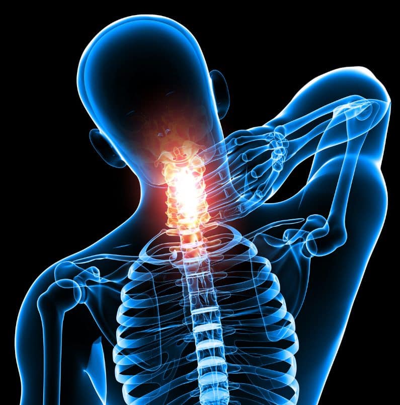 Brian Hwang, MD - Neurosurgeon discusses pain in the neck