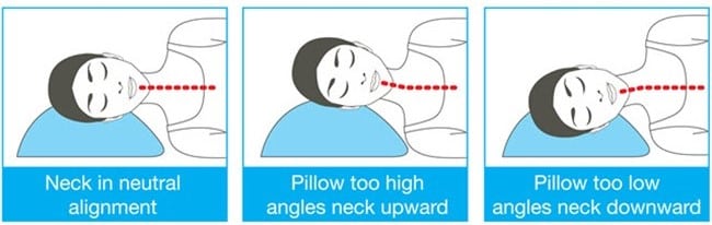 Brian Hwang, MD - Neck Alignment in Side Sleeping