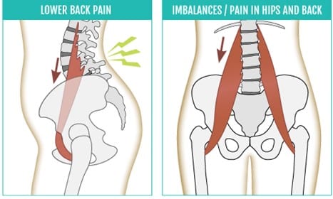 Brian Hwang, D. on Lower Back Pain & Pain in Hips and Back