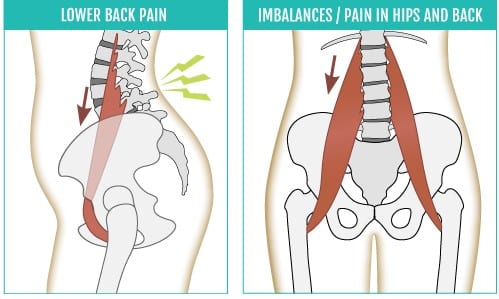 Brian Hwang, MD - Lower back pain, pain in the hips and back